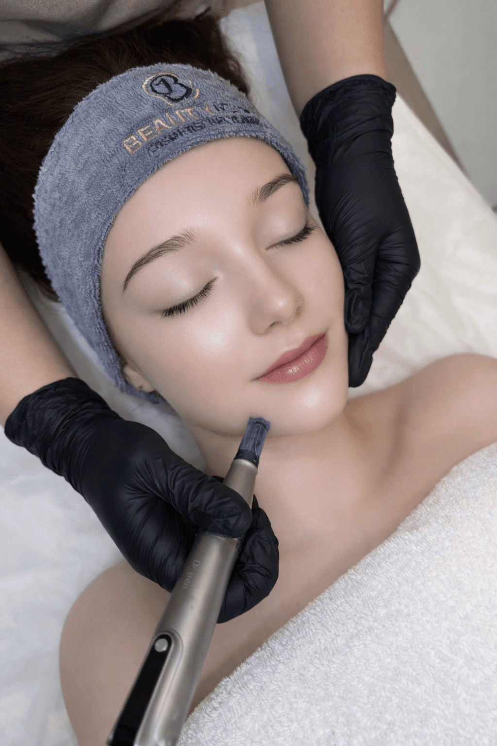 Microneedling behandeling bij Beauty Icon Almere
