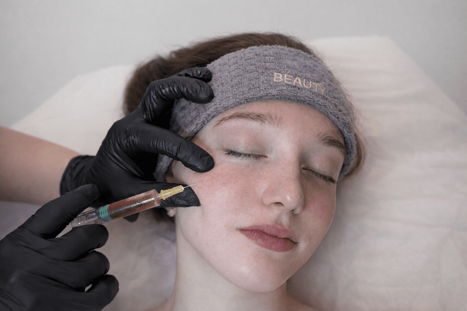 PRP Gezichtsbehandeling behandeling bij Beauty Icon Almere