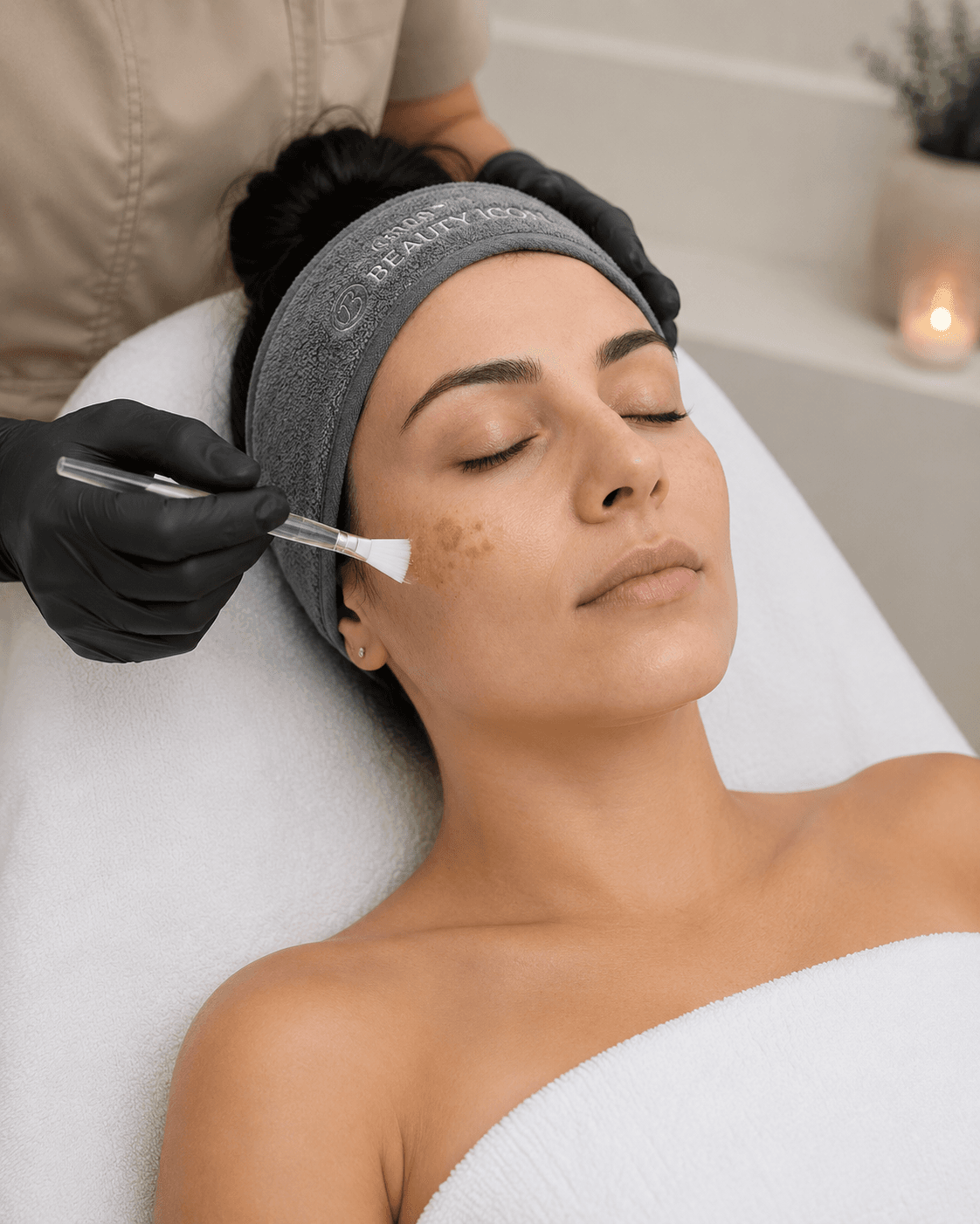 Pigmentvlekken behandeling behandeling bij Beauty Icon Almere